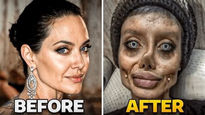 
Sara Platt Turkey Surgery Gone Wrong: Before And After Photo 